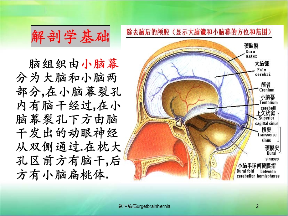 急性脑疝urgetbrainhernia培训课件.ppt_第2页