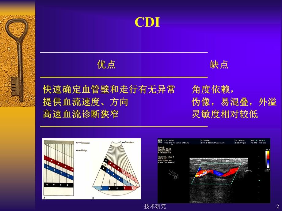 彩色多普勒超声在颈部血管的应用课件.ppt_第2页