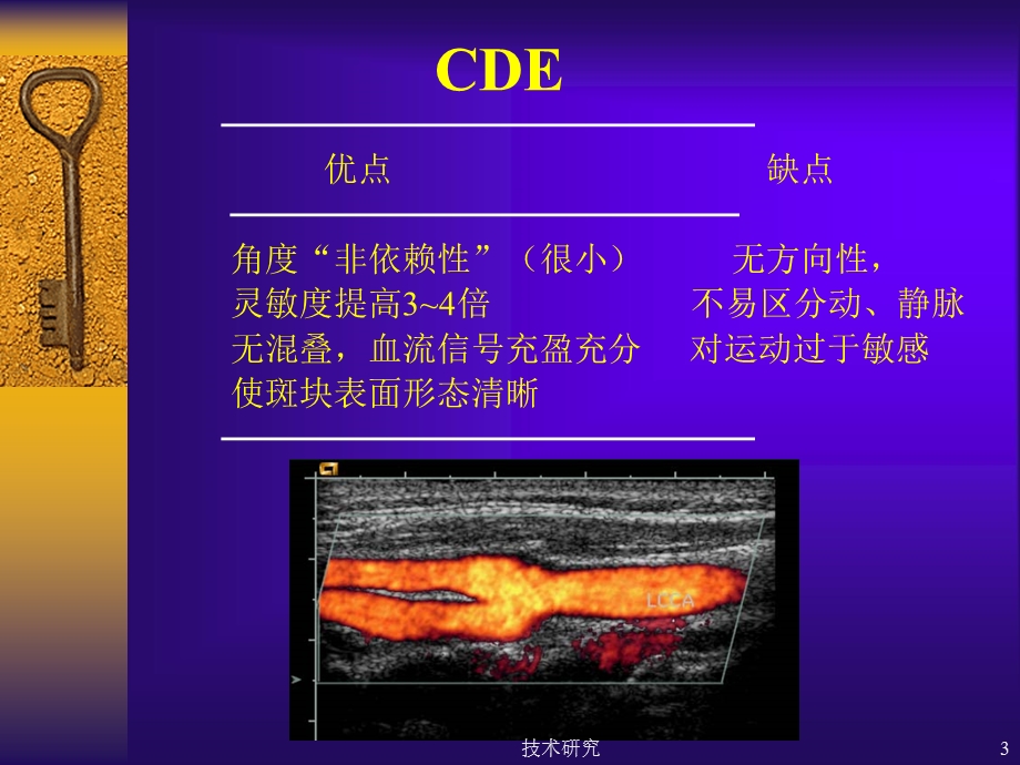 彩色多普勒超声在颈部血管的应用课件.ppt_第3页