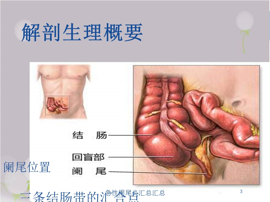 急性阑尾炎汇总汇总培训课件.ppt_第3页