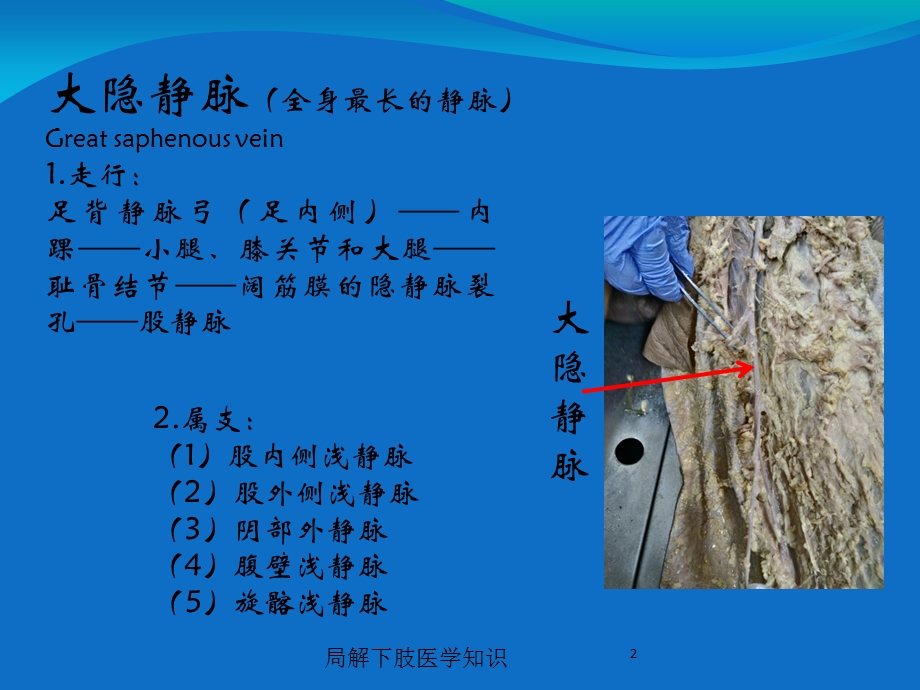 局解下肢医学知识培训课件.ppt_第2页