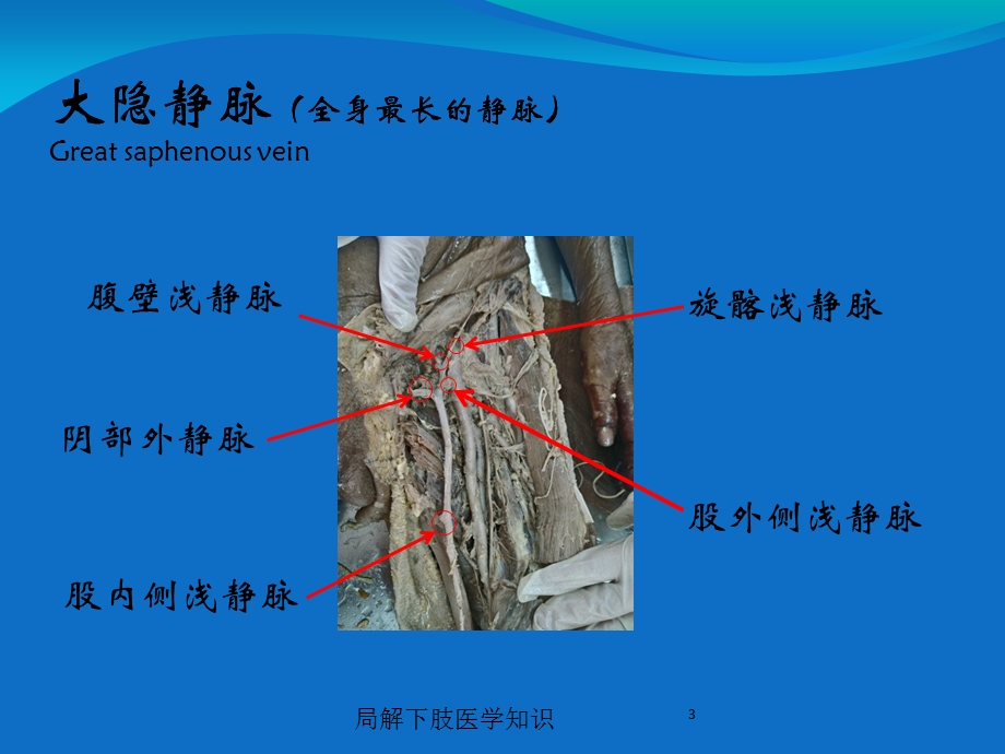 局解下肢医学知识培训课件.ppt_第3页