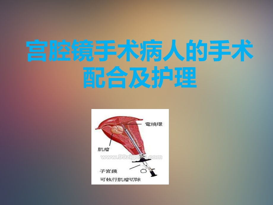 宫腔镜手术病人手术配合及护理ppt课件.ppt_第1页