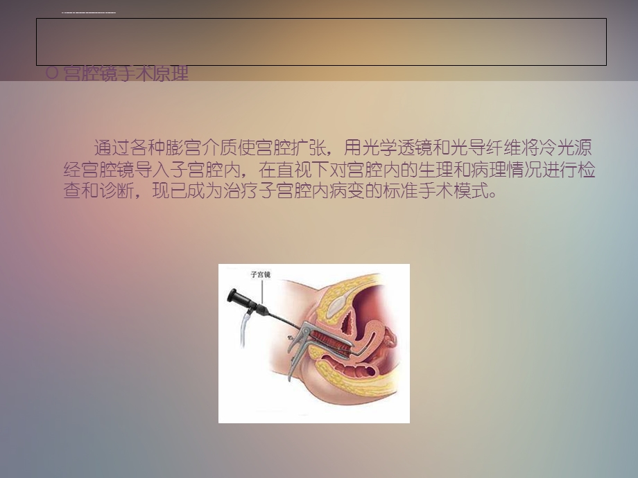 宫腔镜手术病人手术配合及护理ppt课件.ppt_第2页