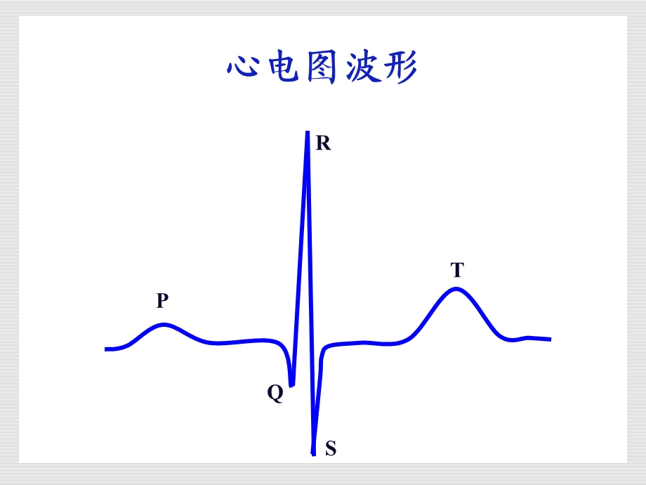 心电图的正确识别ppt课件.ppt_第3页