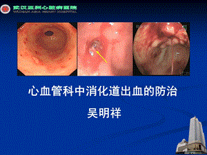 心血管疾病中消化道出血的防治课件医学.ppt