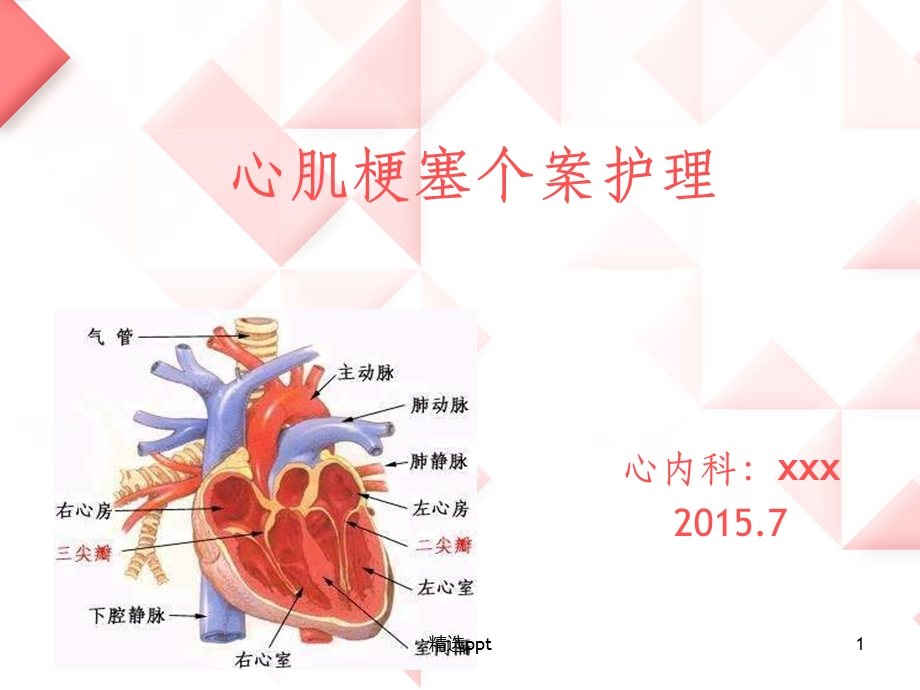 急性心肌梗死护理个案课件.ppt_第1页