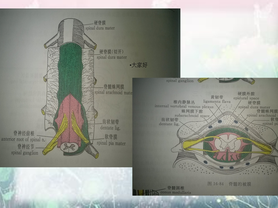 椎管内脊膜瘤的围手术期护理课件.ppt_第3页