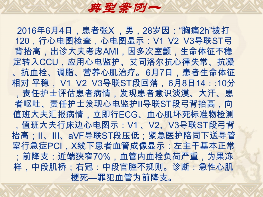 护理人员常见异常心电图的识别ppt课件.ppt_第2页