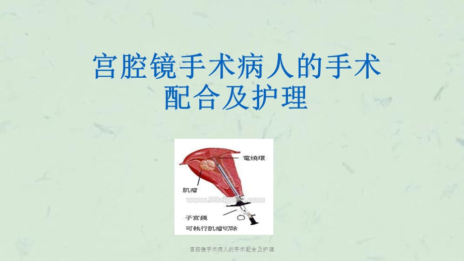 宫腔镜手术病人的手术配合及护理课件.ppt_第1页