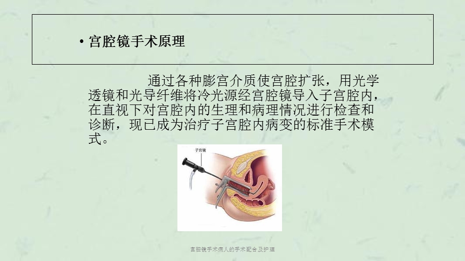 宫腔镜手术病人的手术配合及护理课件.ppt_第2页