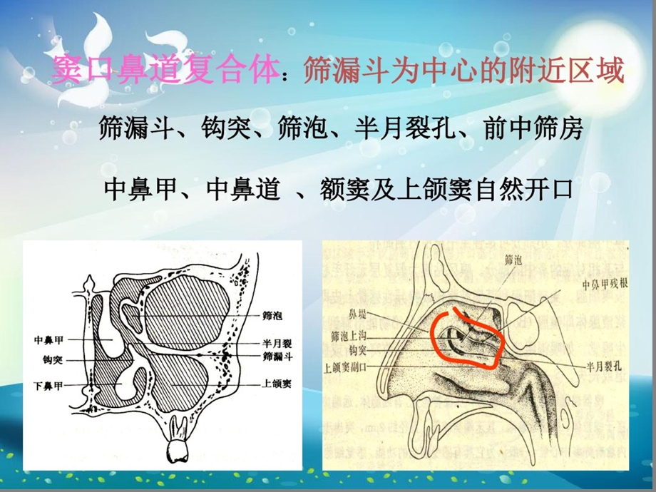 急性鼻窦炎课件.ppt_第3页