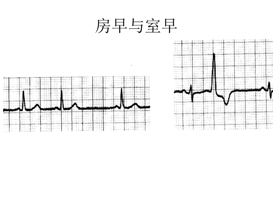 心电图练习题ppt课件.ppt_第3页