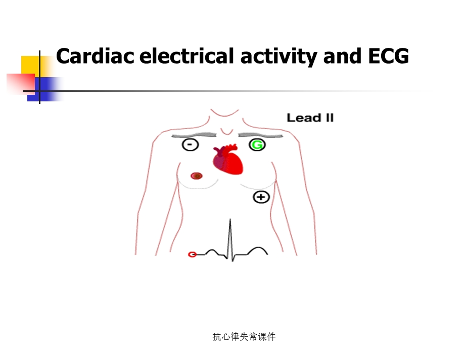 抗心律失常课件.ppt_第3页