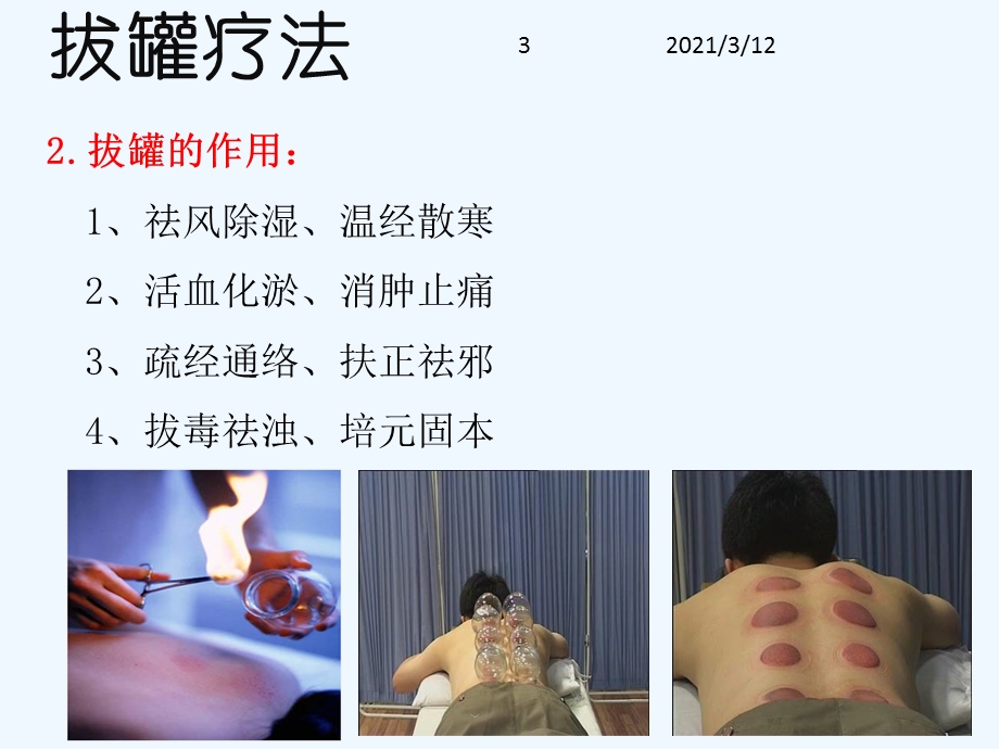 拔火罐疗法中医特色治疗课件.ppt_第3页