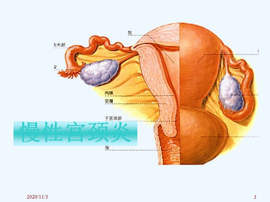 妇科学习之慢性宫颈炎课件.ppt_第3页