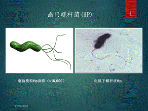 抗HP治疗的方法培训课件.ppt