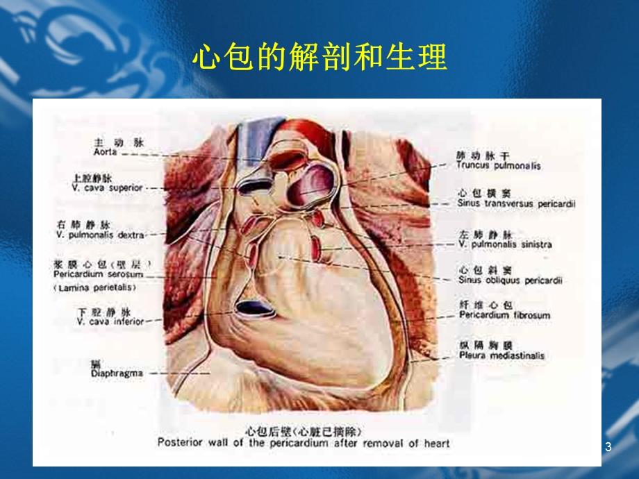 急性心包炎(讲课课件)课件.ppt_第3页