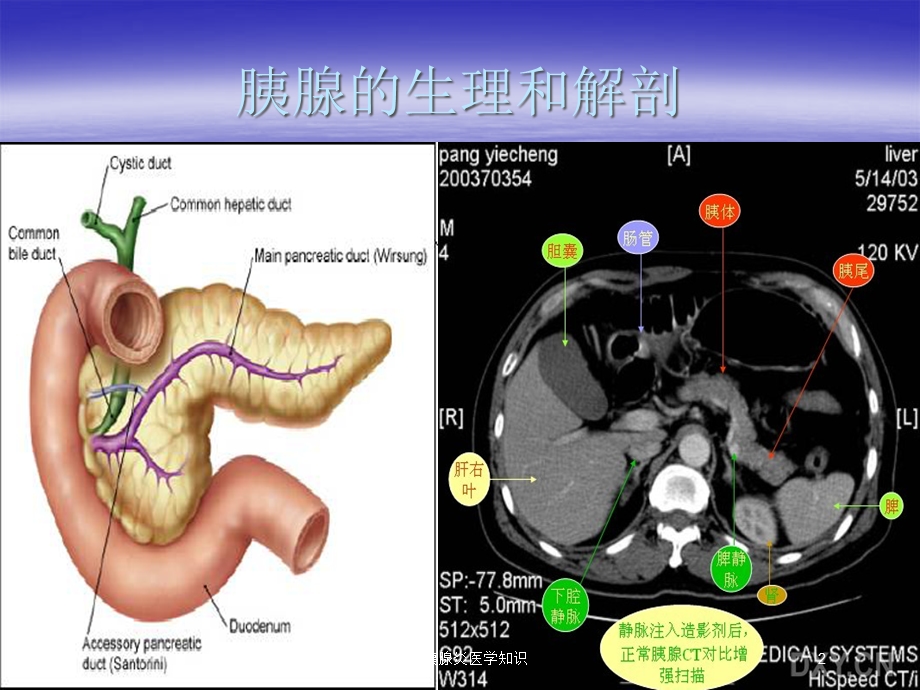 急性胰腺炎医学知识培训课件.ppt_第2页