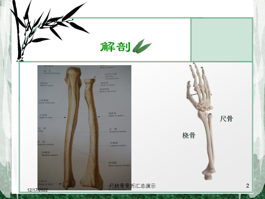 尺桡骨骨折汇总教学课件.ppt_第2页