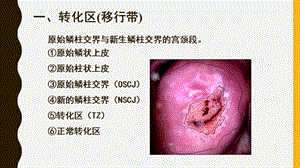 宫颈癌筛查文献汇报HPV和TCT课件.ppt