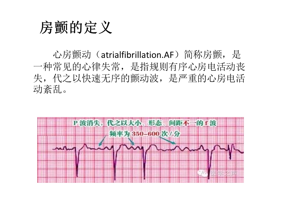 房颤治疗策略课件.pptx_第2页