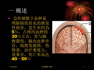 急性硬膜下血肿培训课件.ppt