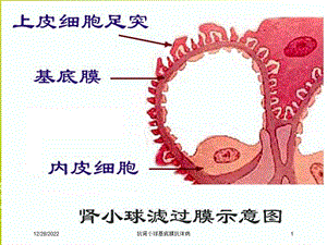 抗肾小球基底膜抗体病培训课件.ppt