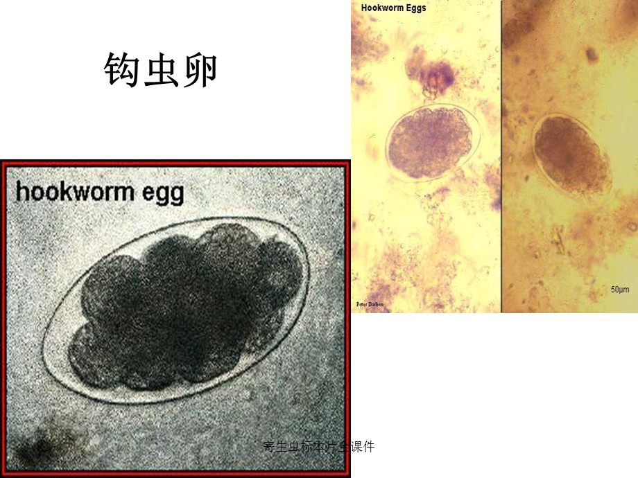 寄生虫标本片全课件.ppt_第3页