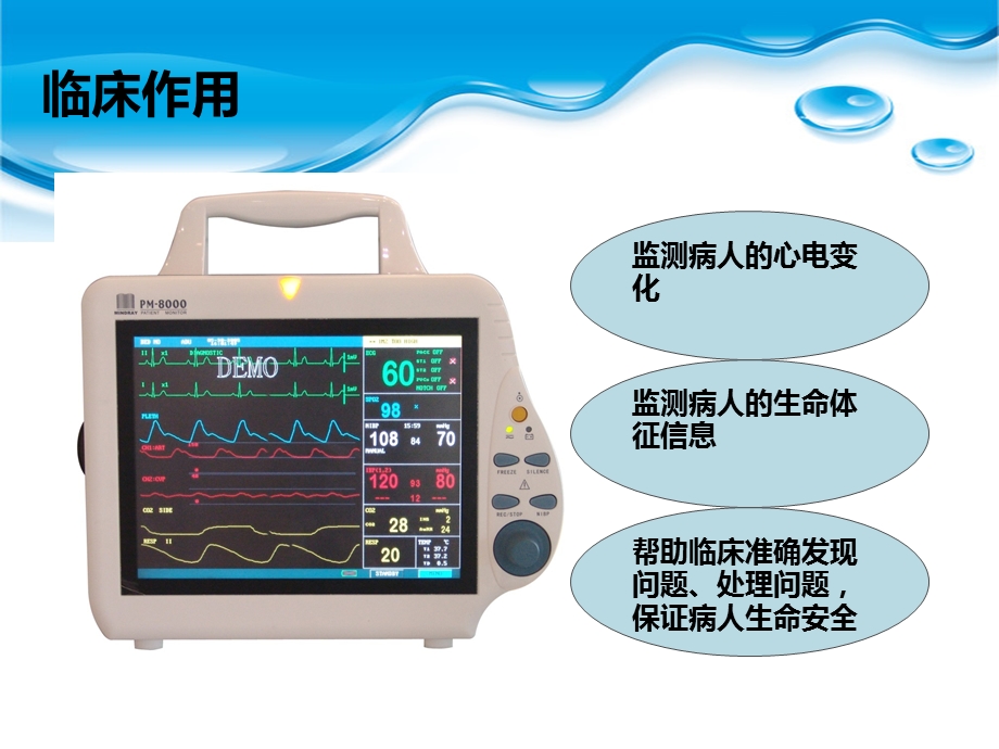 提高监护仪心电图的识别ppt课件.ppt_第2页