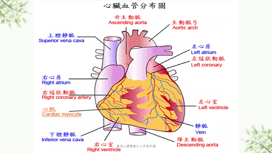 急性心梗患者介入术后护理课件.ppt_第2页