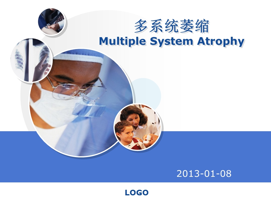 多系统萎缩MultipleSystemAtrophy课件.ppt_第1页