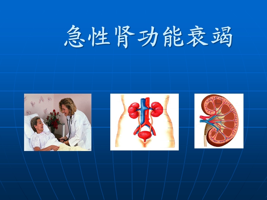 急性肾衰竭下发课件.ppt_第1页