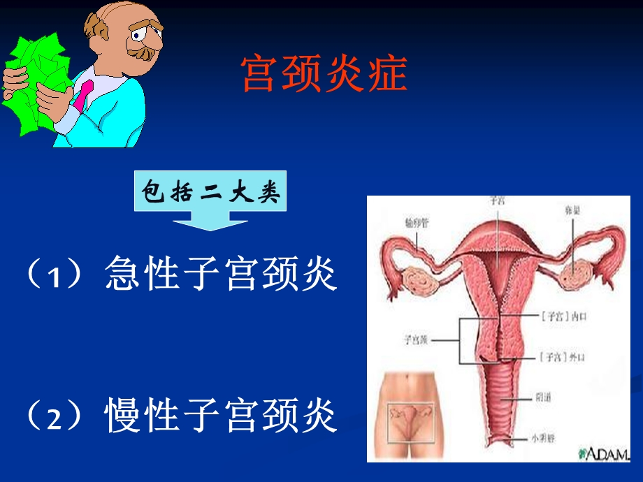 宫颈炎正式ppt课件.ppt_第3页