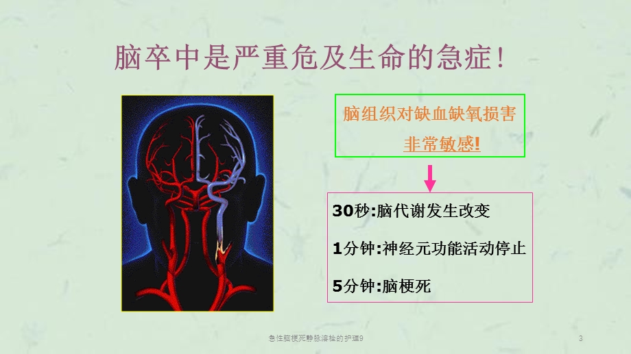 急性脑梗死静脉溶栓的护理9课件.ppt_第3页