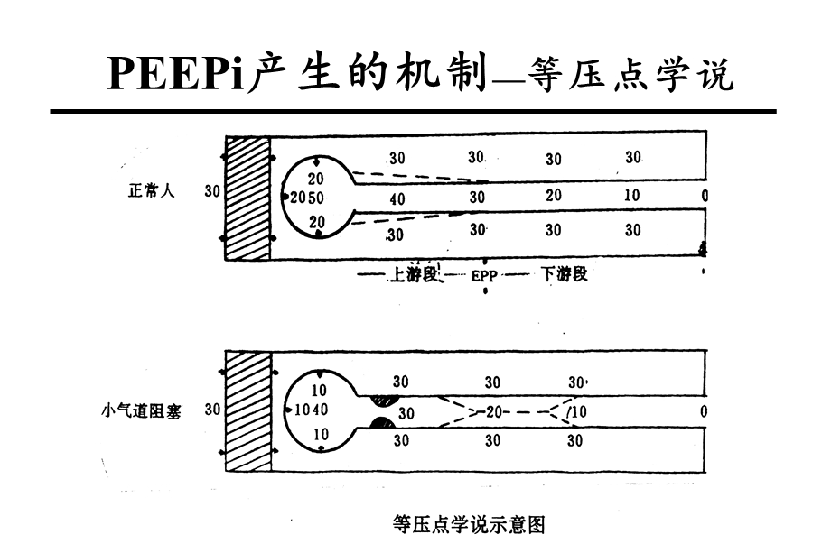 慢性阻塞性肺疾病的机械通气课件.ppt_第3页