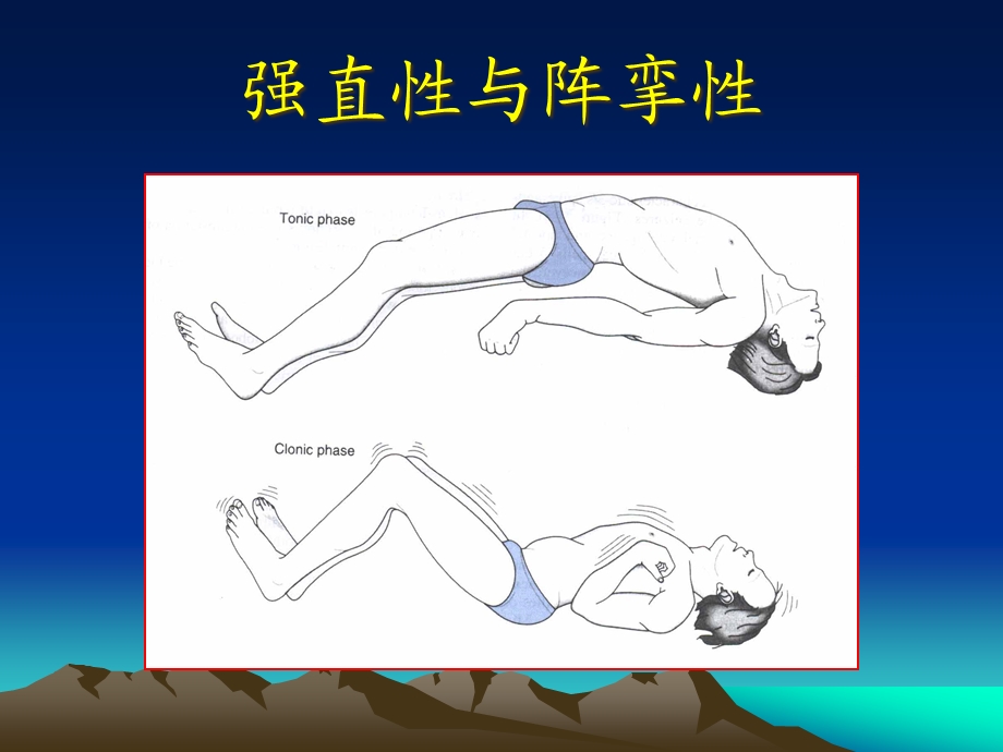 抽搐与惊厥医学知识讲座培训课件.ppt_第3页