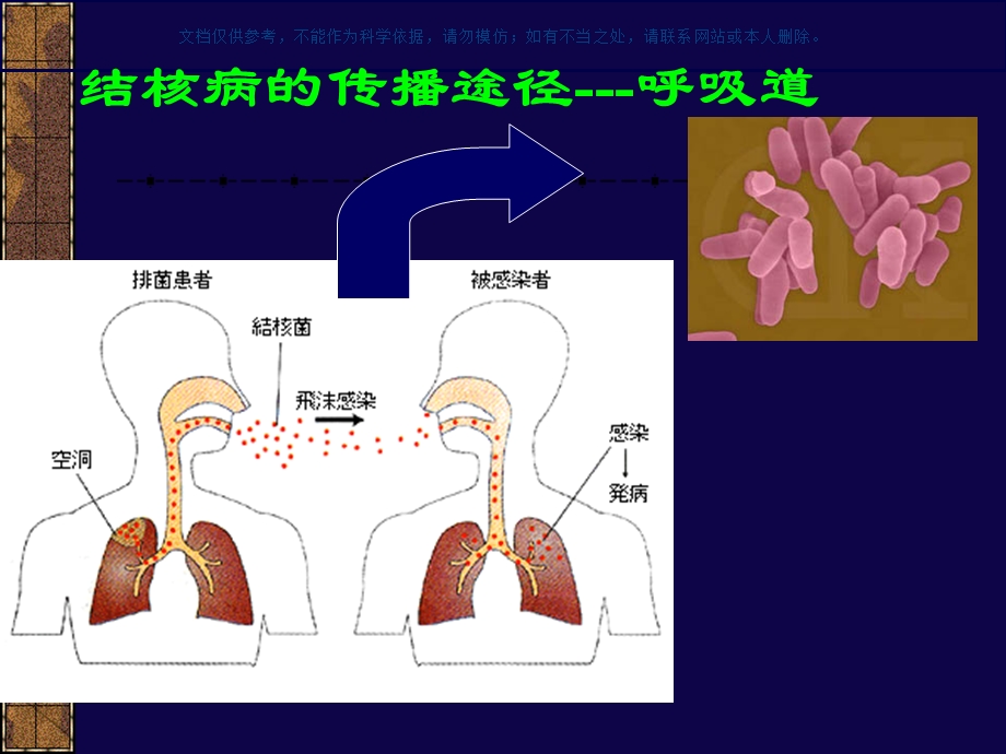 抗结核病药专题知识课件.ppt_第3页