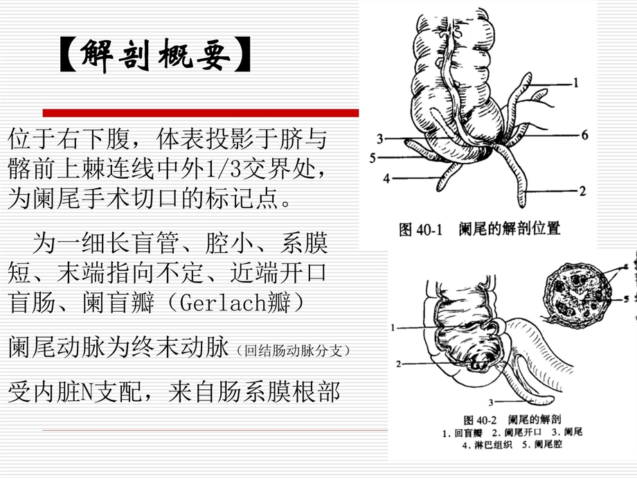 急性阑尾炎及护理ppt课件.pptx_第3页