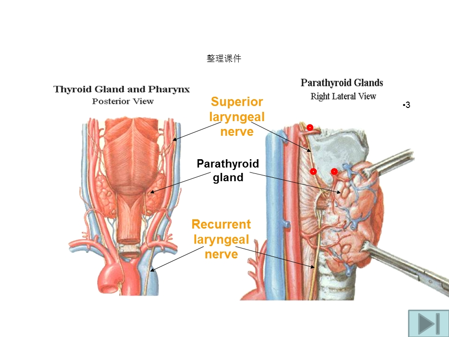 甲状腺癌的临床表现及处理原则课件.ppt_第3页