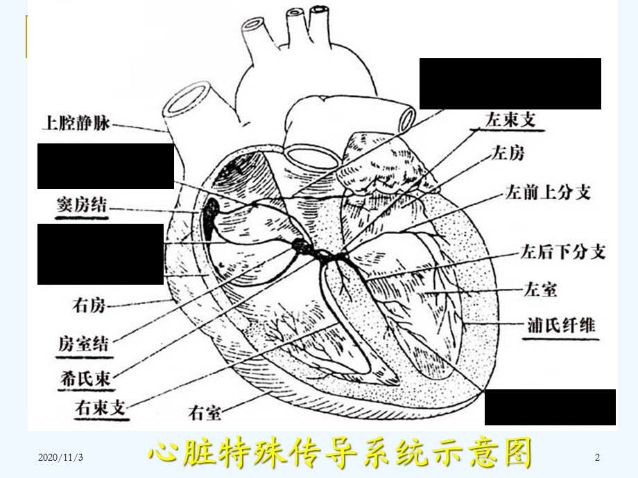 常见异常心电图的鉴别与诊断技巧课件.ppt_第2页