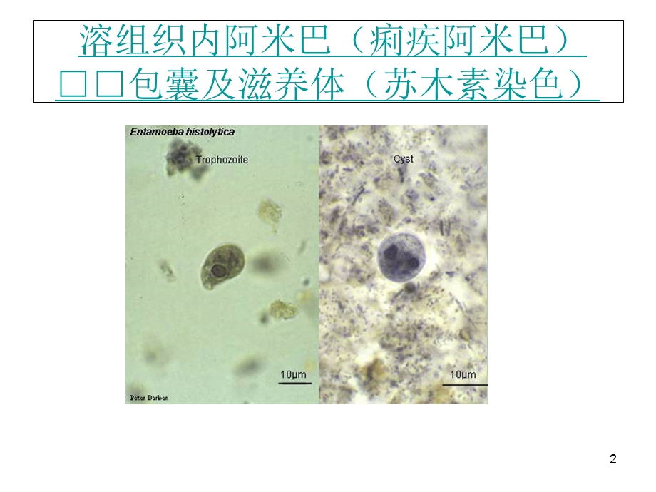 常见寄生虫图谱教学课件.ppt_第2页