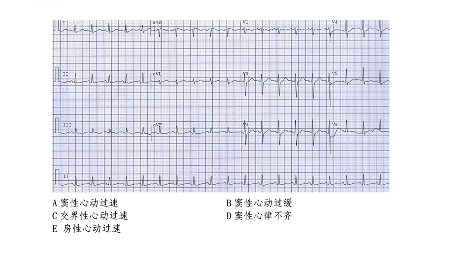 心电图练习题（带图有答案）ppt课件.ppt_第1页