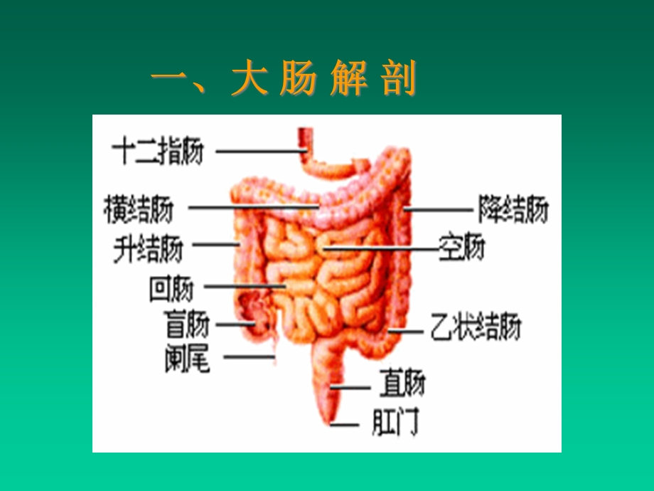 大肠癌医学知识讲座课件.ppt_第2页