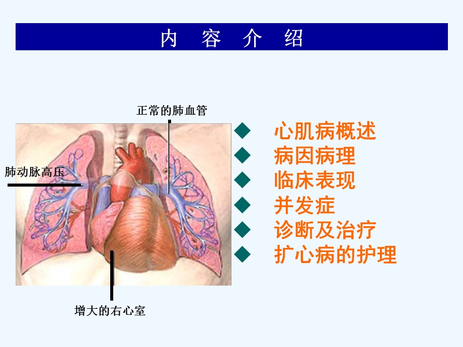 扩张型心肌病查房课件.ppt_第2页