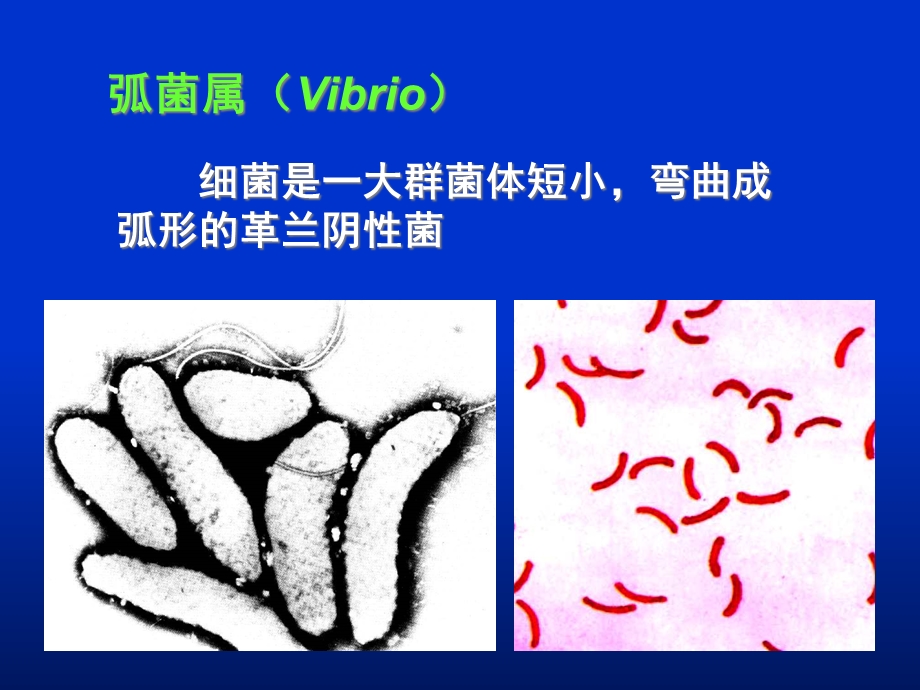 弧菌属医学知识讲座课件.ppt_第2页