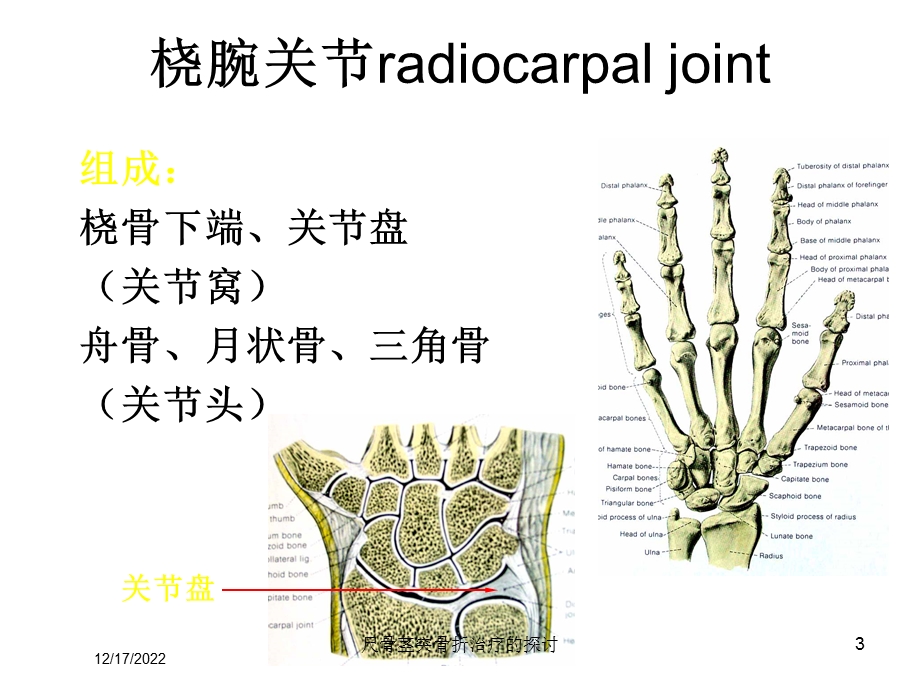 尺骨茎突骨折治疗的探讨课件.ppt_第3页