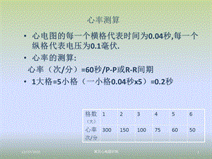 常见心电图识别课件.ppt