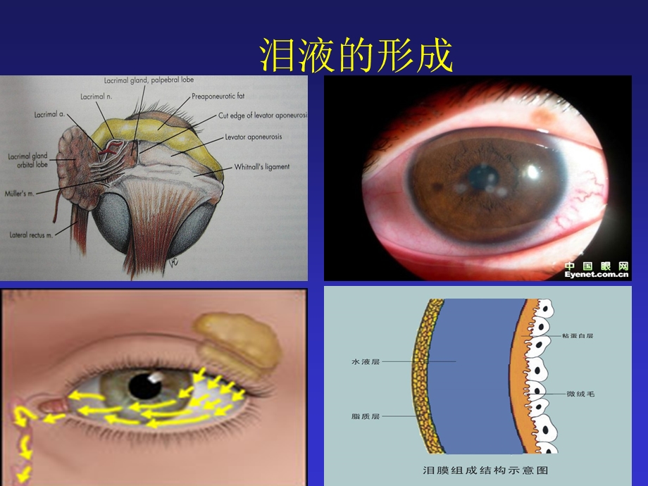 干眼症的防治PPT课件.ppt_第3页