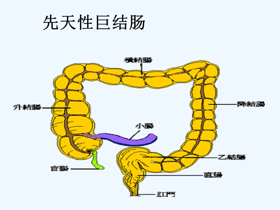 巨结肠洗肠流程课件.ppt_第3页